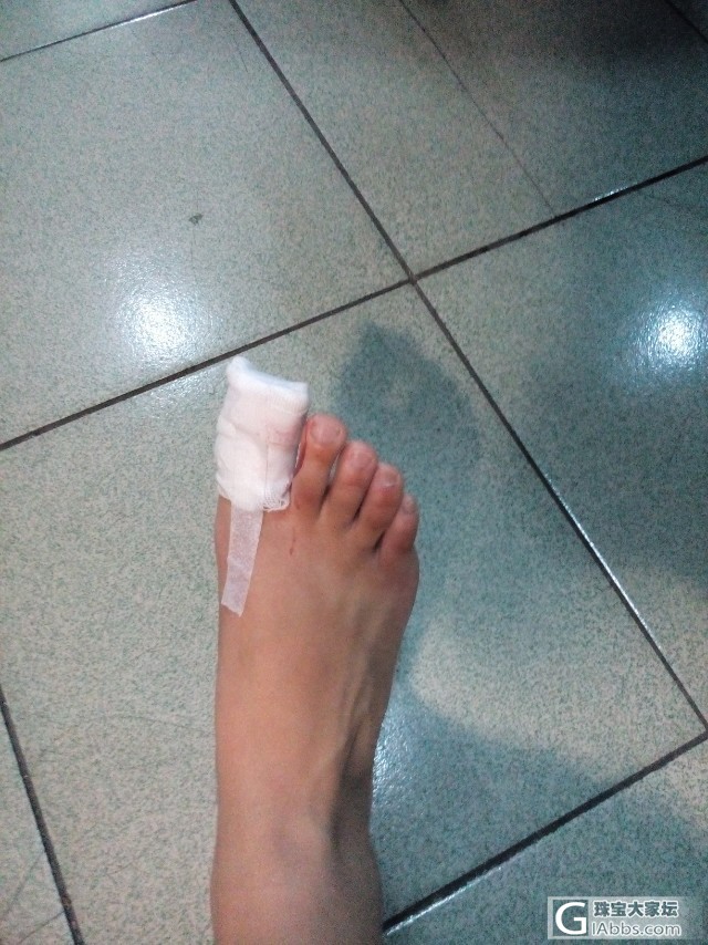 脚趾甲掉了要多久能好